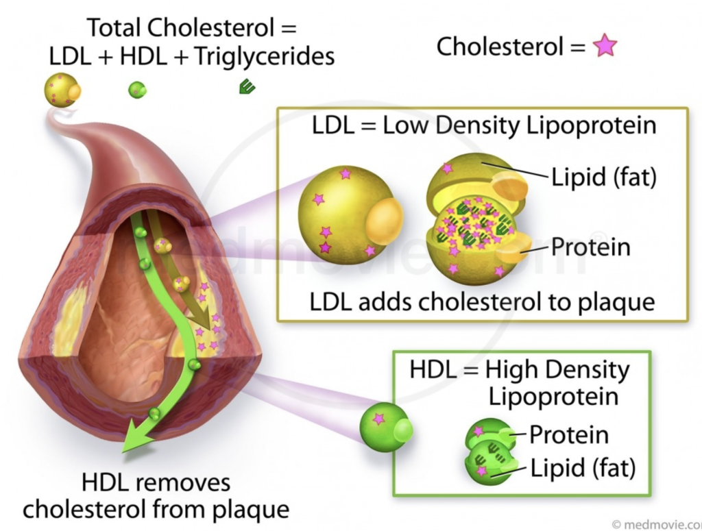 Bioresonance Treat Cholesterol